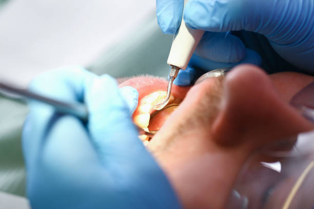 Best Emergency Treatment for Toothache in Sleepy Hollow, CA